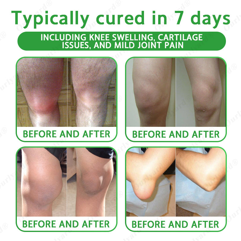 🏅TGA Approved|Ourlyard® Advanced Magnesium & Emu Oil Massage Pain Relief Cream (🏅The Ultimate Solution for Muscle Aches, Arthritis, Joint Pain, Nerve Pain, Inflammation, and Stiffness)