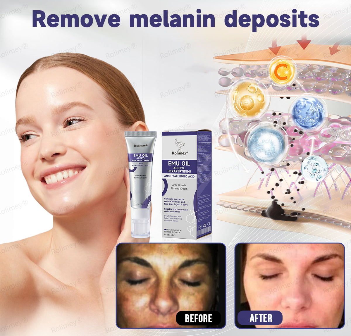 🌟Made in Australia: Rolimey® Emu Oil Anti-Wrinkle Firming Cream (Dermatologist Recommended)