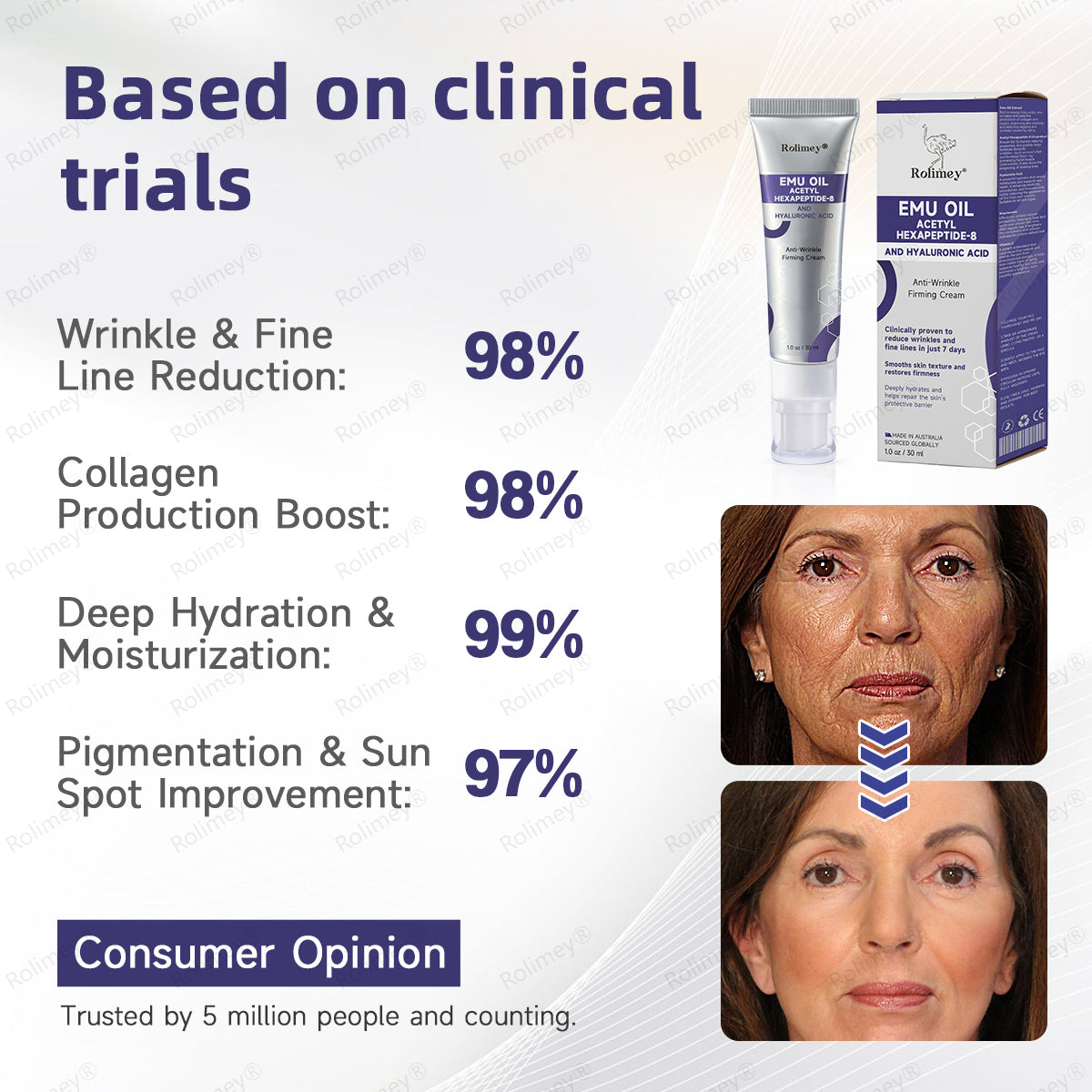 🌟Made in Australia: Rolimey® Emu Oil Anti-Wrinkle Firming Cream (Dermatologist Recommended)