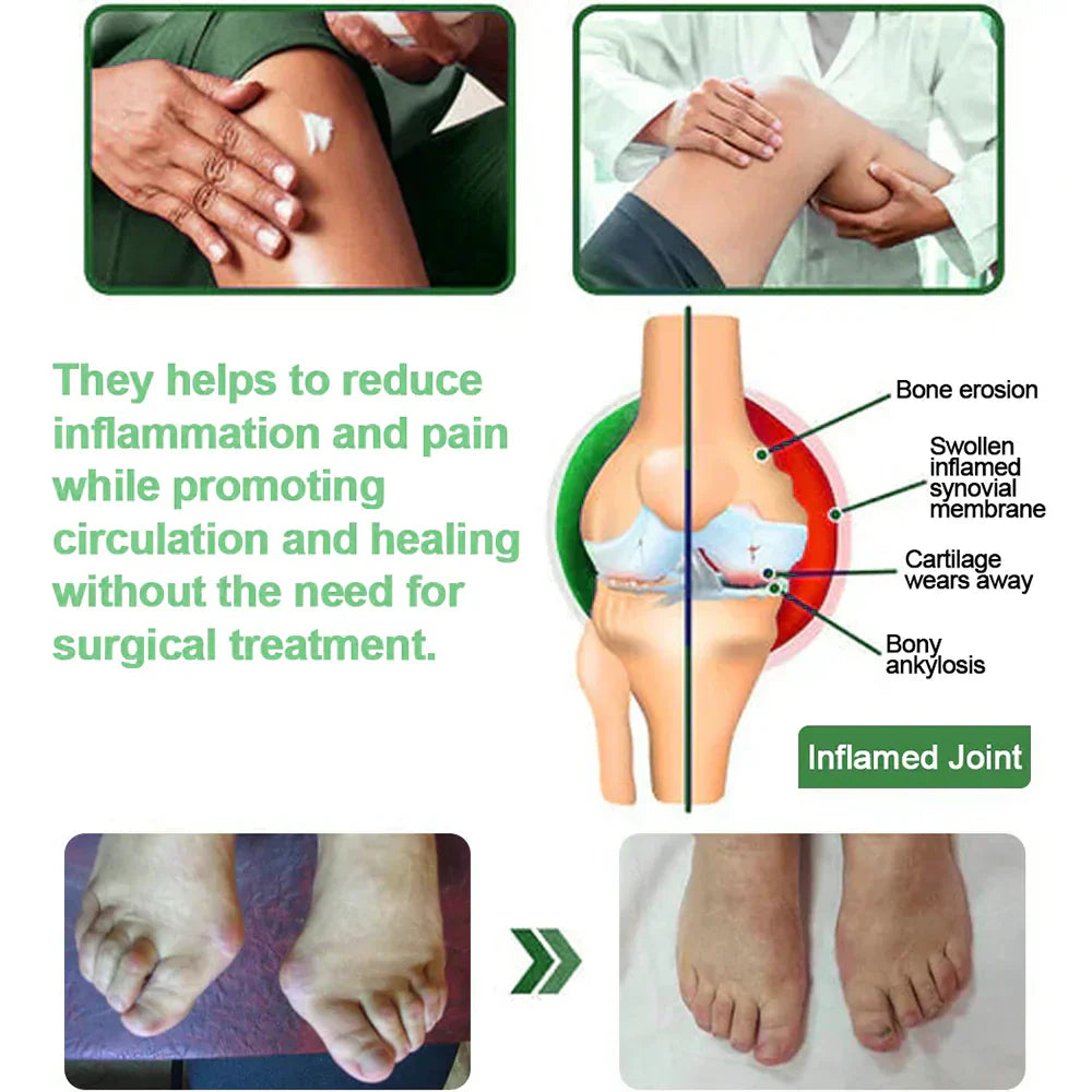 (Made in the Australia)🏅Final 3 Hours: 60% OFF 𝐎𝐟𝐟𝐢𝐜𝐢𝐚𝐥 𝐒𝐭𝐨𝐫𝐞: 𝐎𝐮𝐫𝐥𝐲𝐚𝐫𝐝® Mint Pain Relief Cream (Treatment for arthritis, neuropathyy, rheumatic diseases, muscle spasms, twitches and sports injuries)