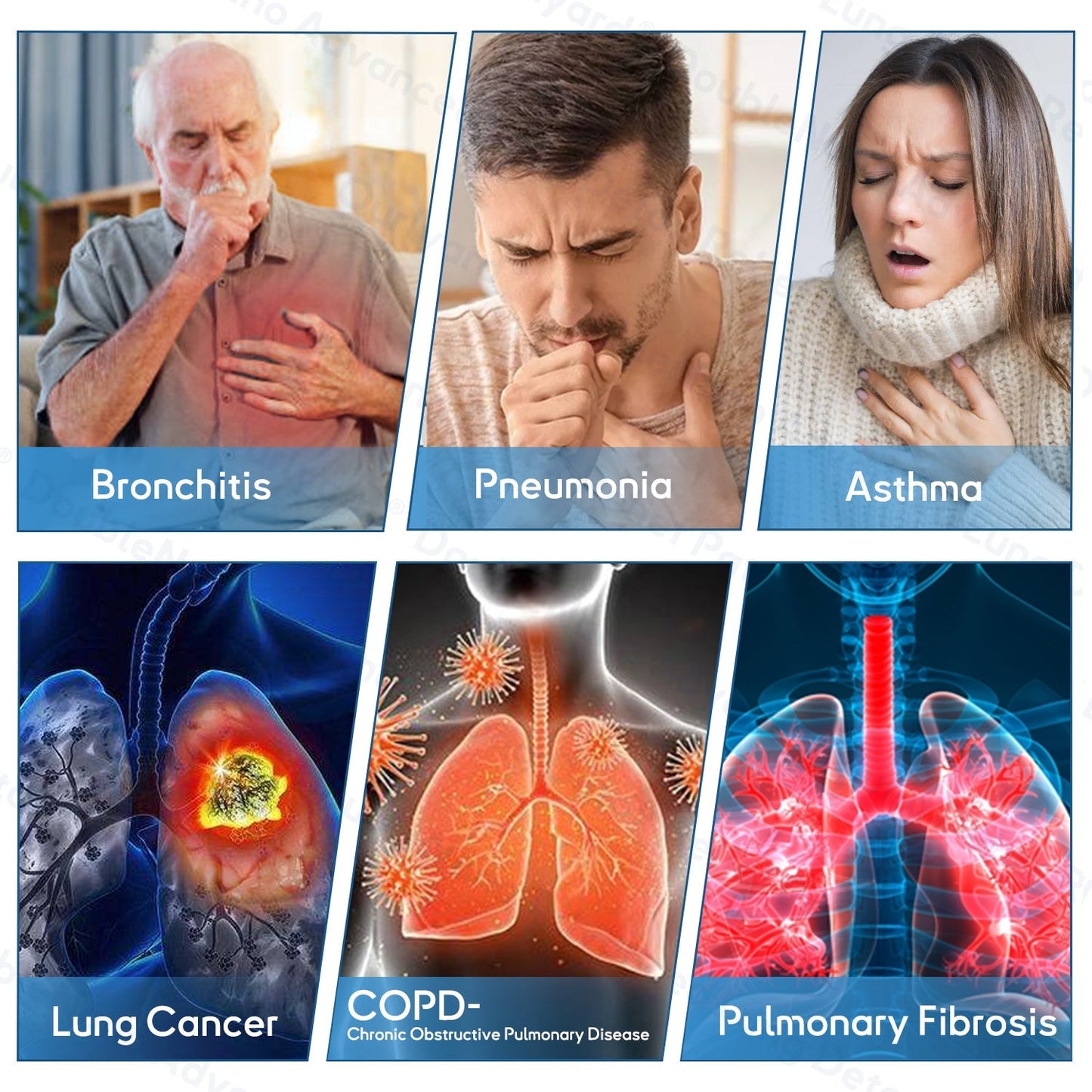 ✅TGA Approved|Zvoevo® DoubleNano COPD Relief Patch (💝 Cough, wheezing, shortness of breath, sputum, stuffy nose, bronchitis, bronchitis, allergy symptoms, lung discomfort🫁)