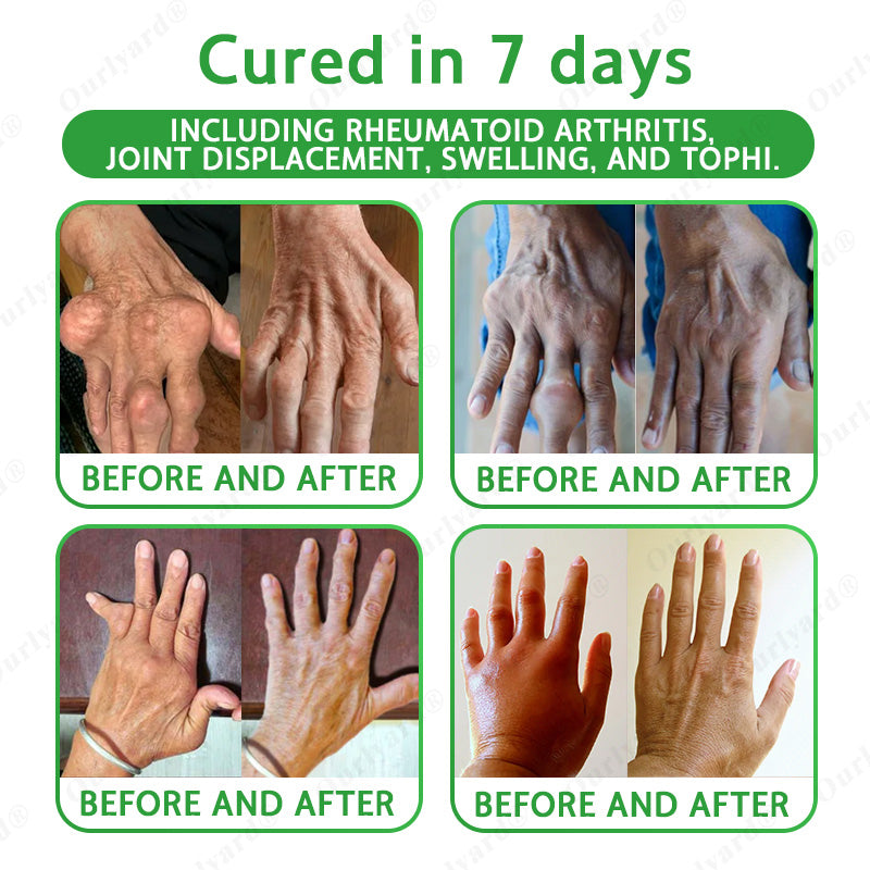 ✅🌿TGA Approved|Ourlyard® Advanced Magnesium & Emu Oil Massage Pain Relief Cream (🏅The Ultimate Solution for Muscle Aches, Arthritis, Joint Pain, Nerve Pain, Inflammation, and Stiffness)