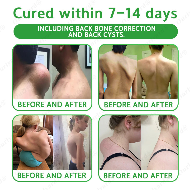 🦵Ourlyard® Advanced Magnesium & Emu Oil Massage Pain Relief Gel (🏅The Ultimate Solution for Muscle Aches, Arthritis, Joint Pain, Nerve Pain, Inflammation, and Stiffness) – Made in Australia